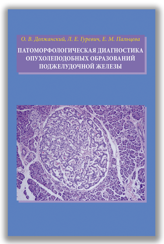 Патоморфологическая диагностика опухолеподобных образований поджелудочной железы